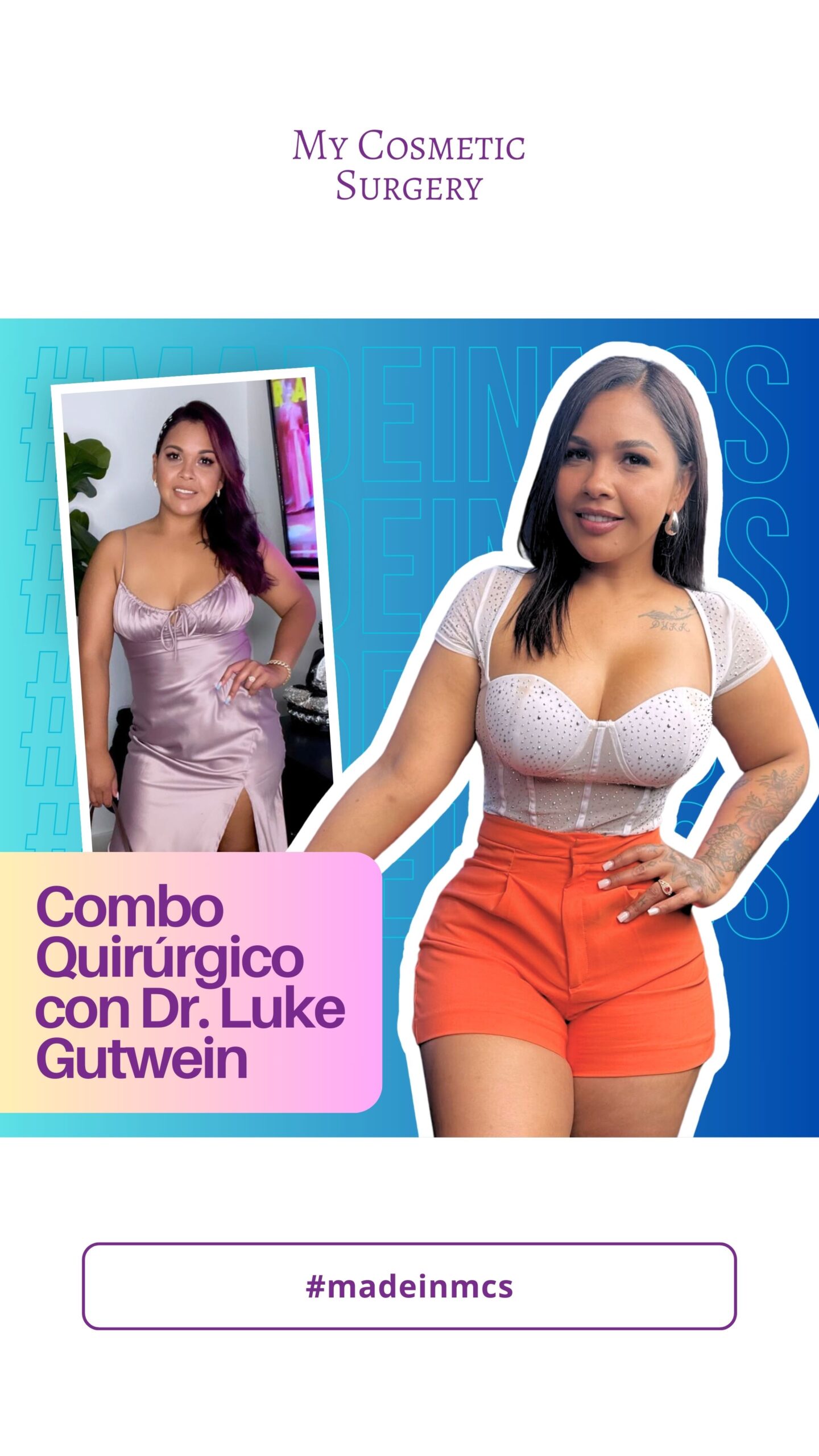 La chulada my cosmetic surgery