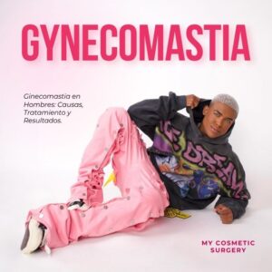 Gynecomastia