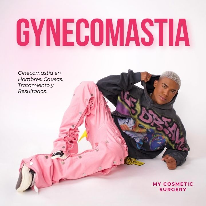 Gynecomastia
