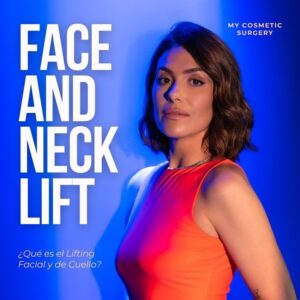 Facelift