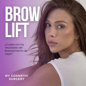 Brow Lift