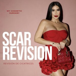Scar revision