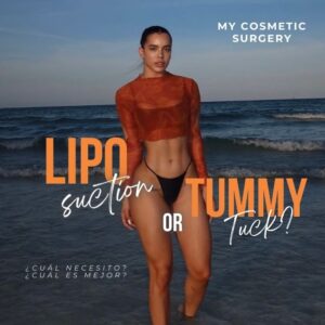 Liposuction