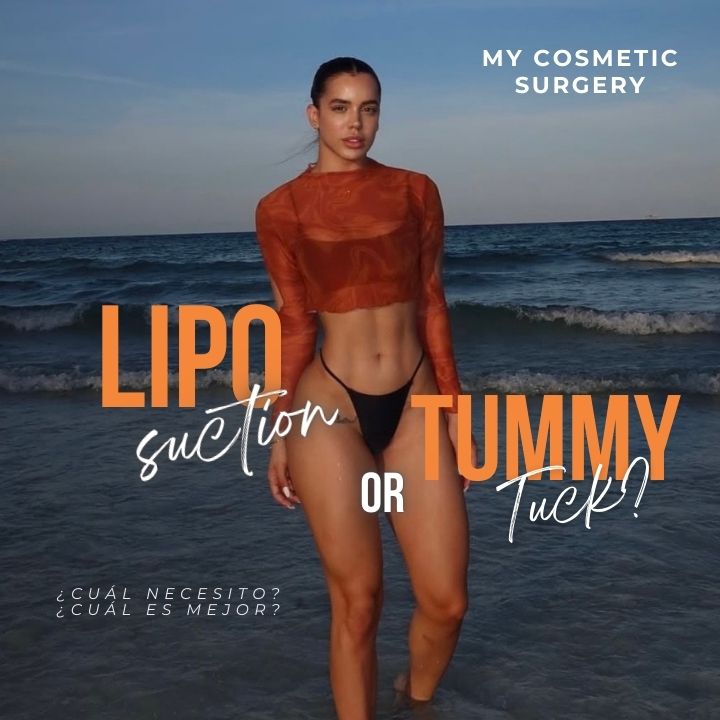 Liposuction