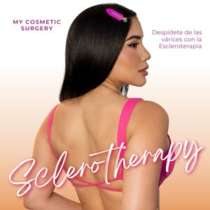 Tratamiento de escleroterapia en My Cosmetic Surgery para eliminar várices y mejorar la salud y apariencia de las piernas