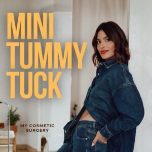 Mini tummy tuck
