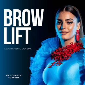 brow lift
