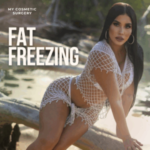 Fat Freezing