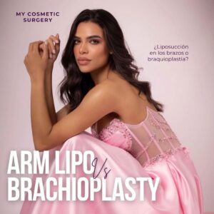 Arm Liposuction