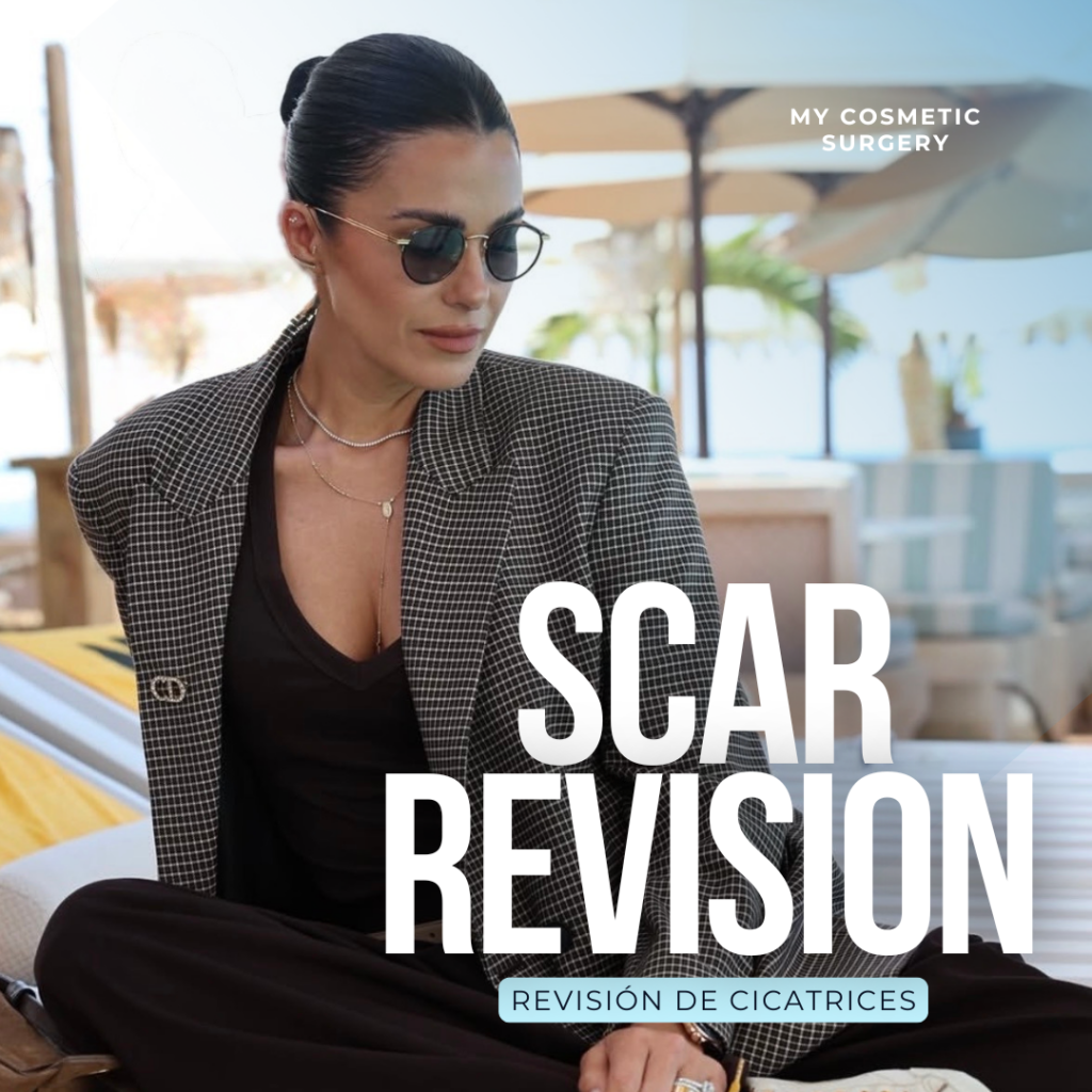 Elegant woman wearing sunglasses promoting scar revision treatment at My Cosmetic Surgery Miami.