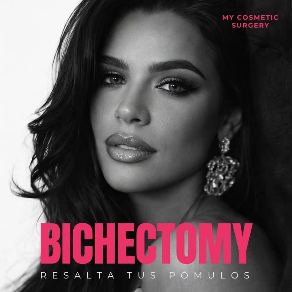 Bichectomy image from My Cosmetic Surgery Miami featuring the topic of buccal fat removal for enhancing facial contour and highlighting the cheekbones.