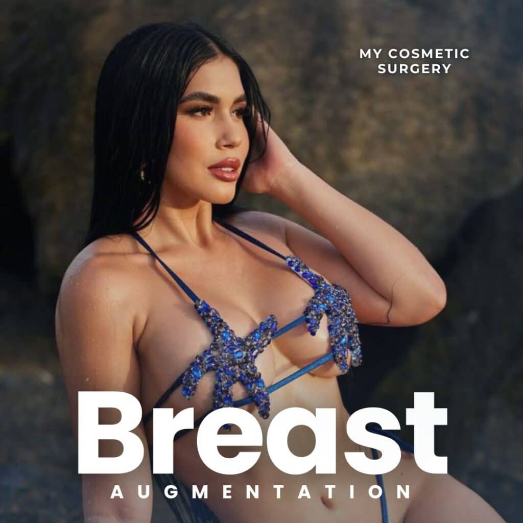 Breast augmentation