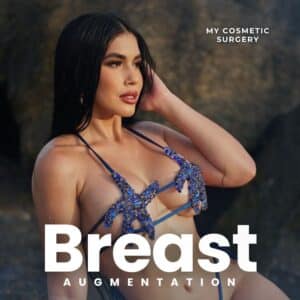 Breast augmentation